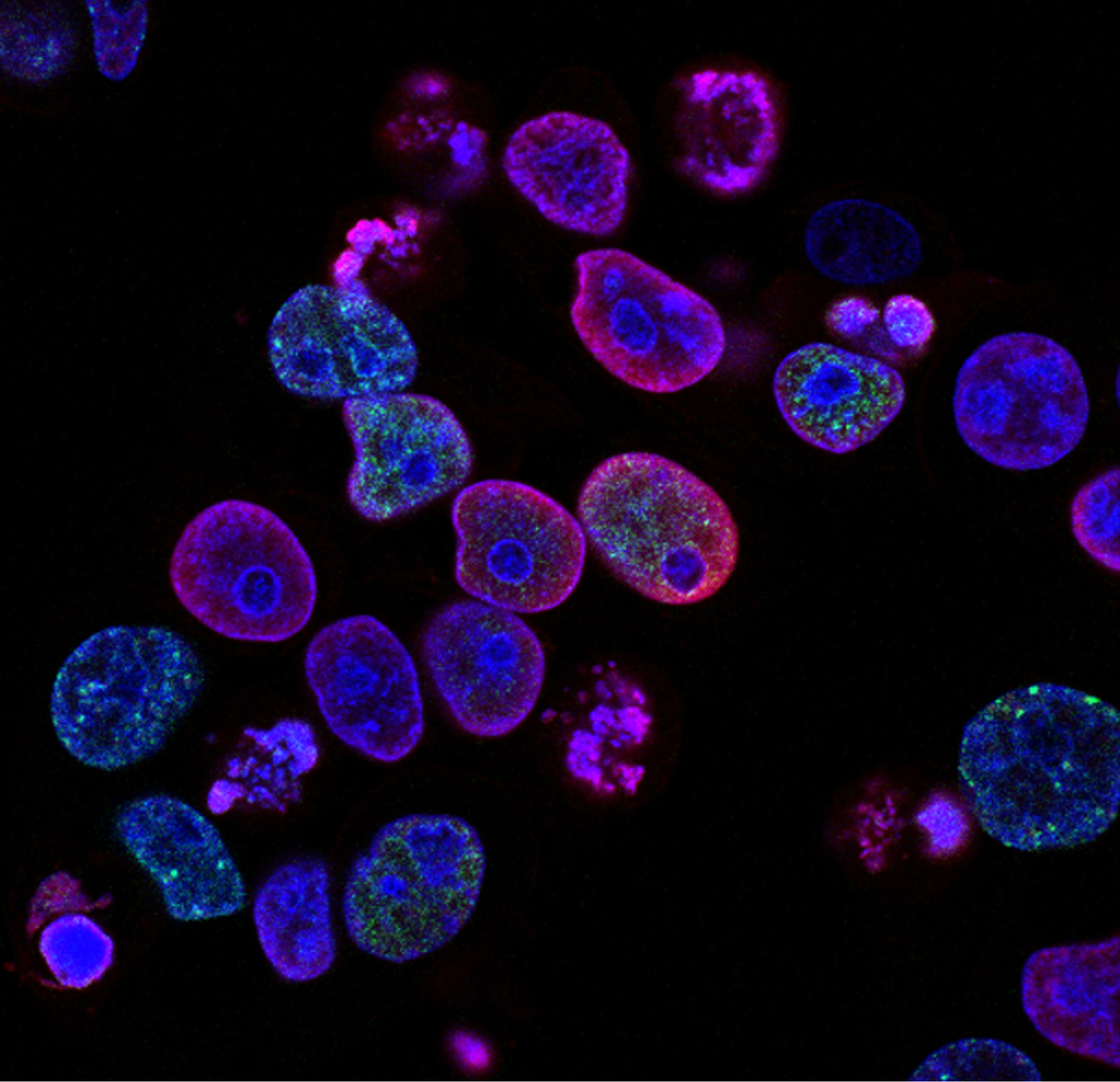 national-cancer-institute-L7en7Lb-Ovc-unsplash