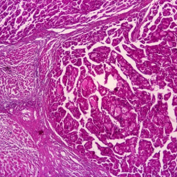 Pierre Fabre R&D Oncology Biotherapy