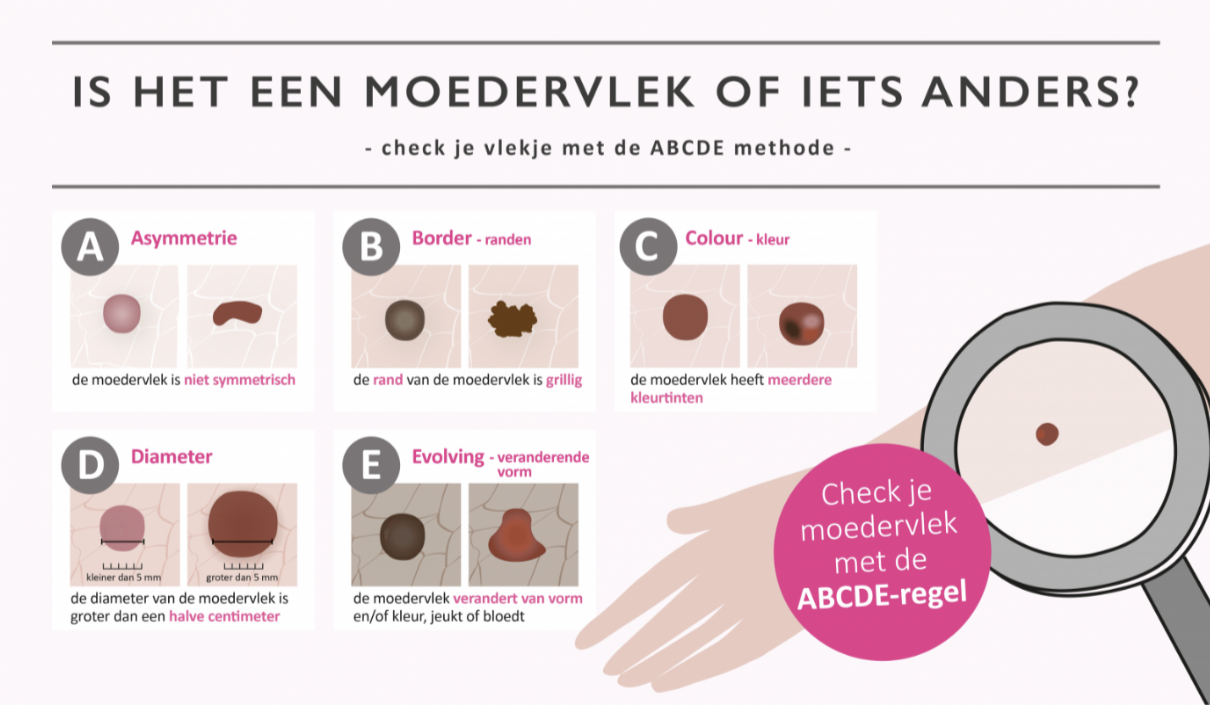 Moedervlek Of Iets Anders