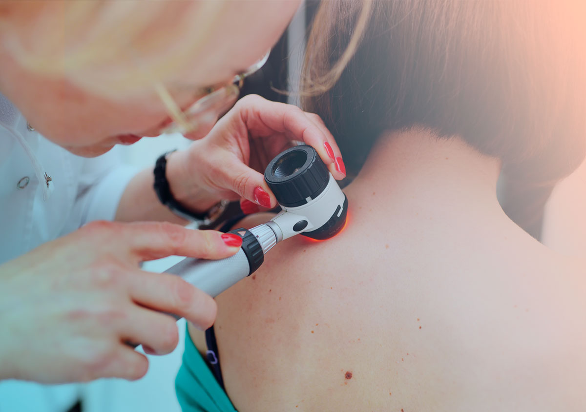 Oncologist Melanoma 2