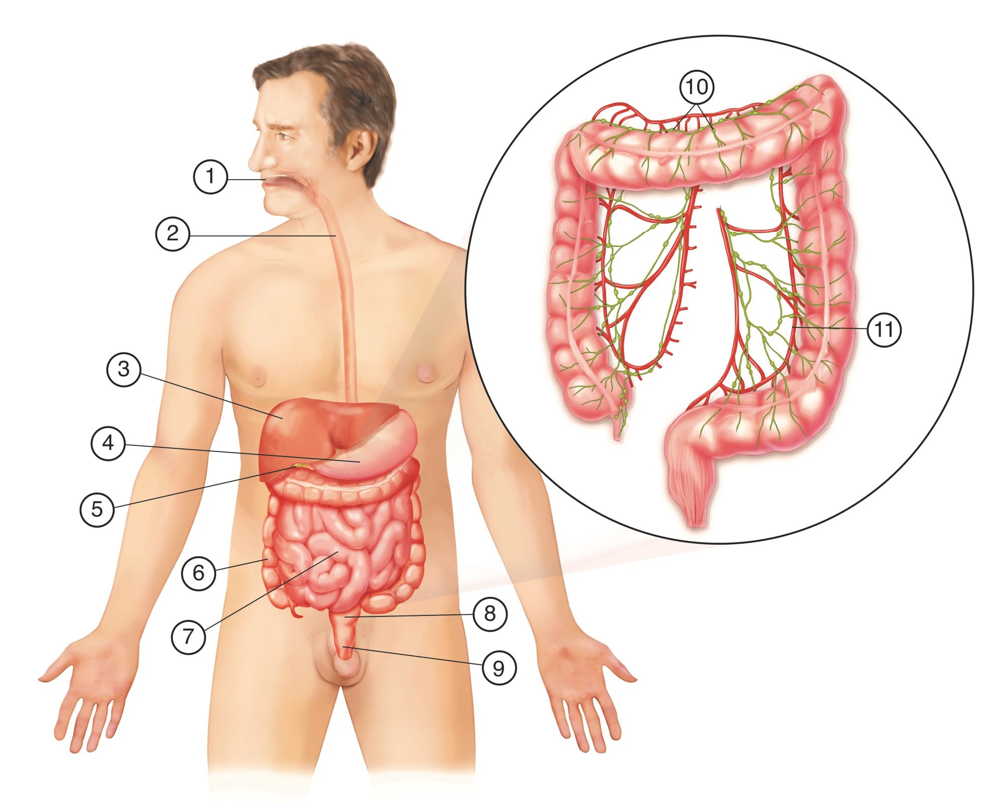 Beeldbank Colorectaal Carcinoom